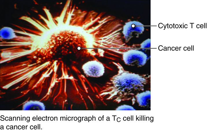 Scanning electron micrograph of a Tc cell killing a cancer cell