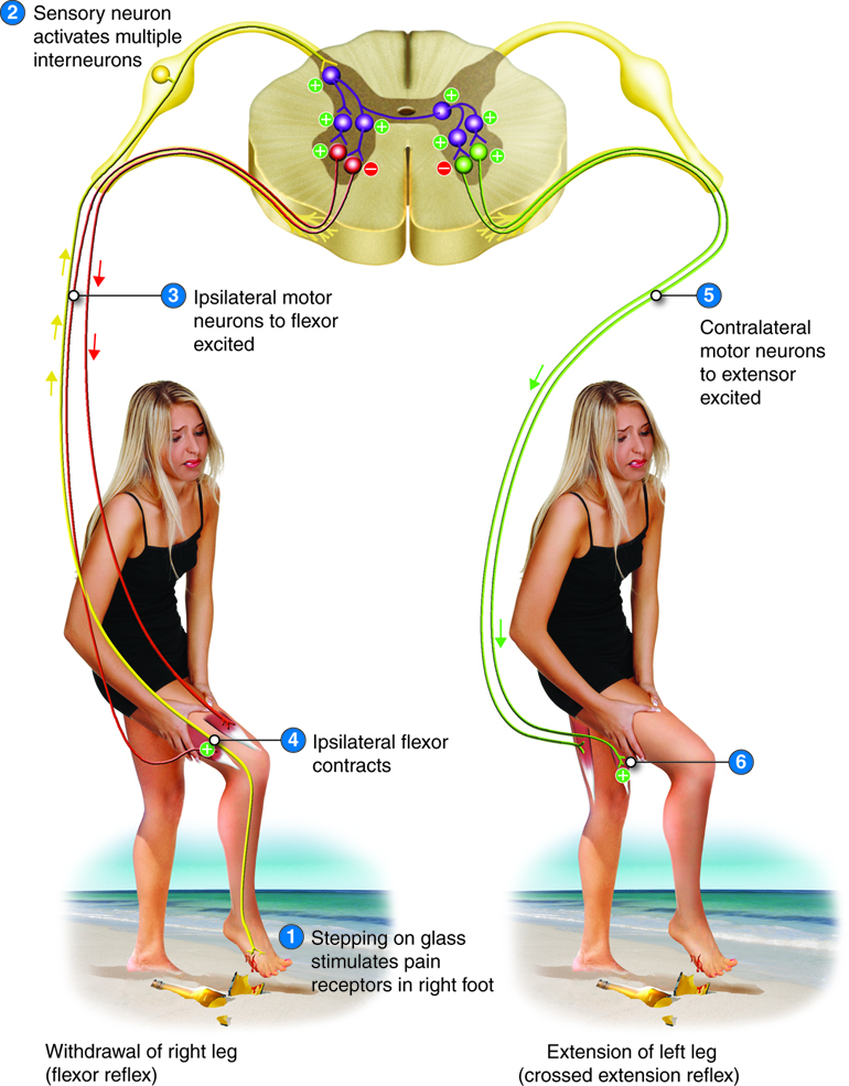 Crossed-Extensor Reflex. In this reflex, as withdrawal from the damaging stimulus occurs in the ipsilateral leg, extension occurs in the contralateral leg as a way of maintaining balance.