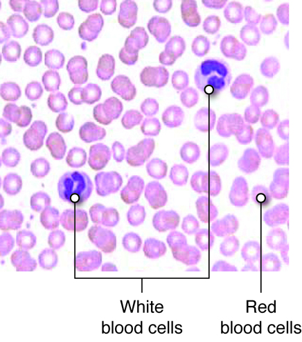 Microscopic image showing white blood cells and red blood cells